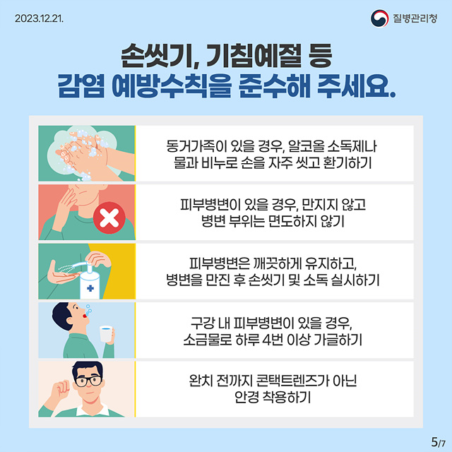 지금 우리가 알아야 하는 질병이야기 #16  엠폭스4